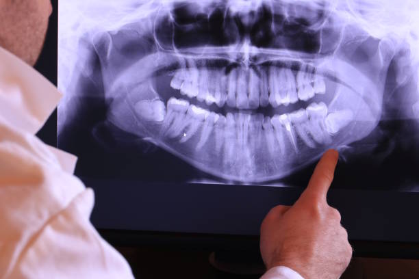 Best Walk-In Emergency Dental Services in Custer, SD