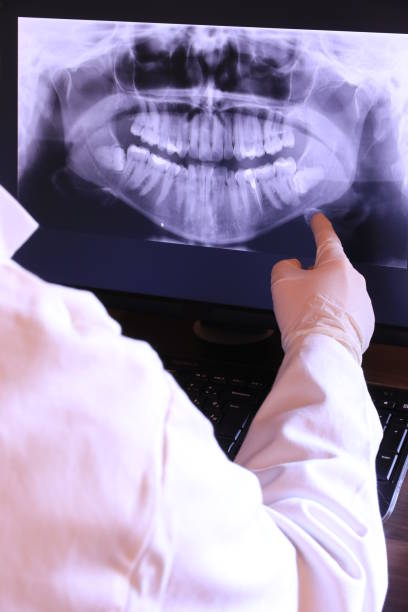 Best Broken or Chipped Tooth Repair in Custer, SD